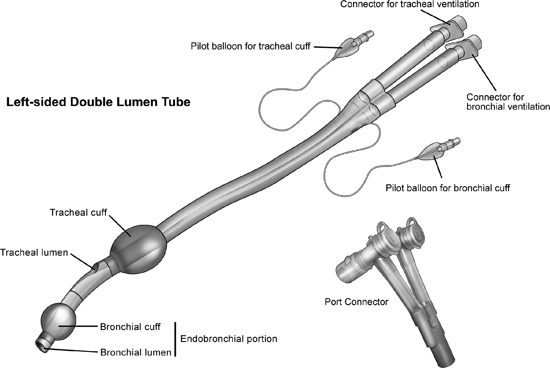 Replacing Double Lumen Tube with Single Lumen Tube